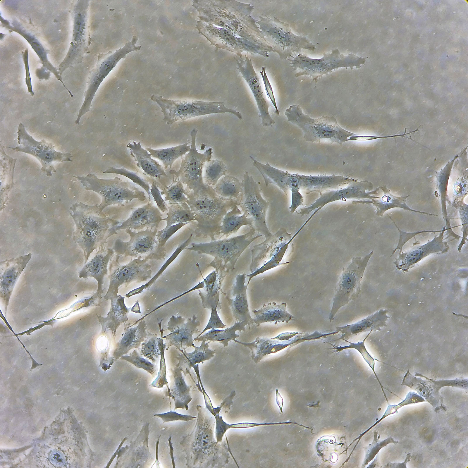 Undifferentiated SHSY5Y cells, day 0